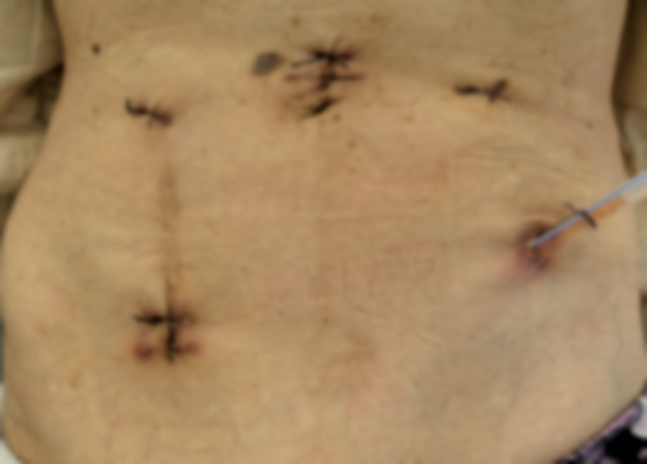 1757896783452695.png 微信圖片_2025-09-15_083910_895.png